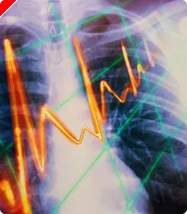 Poker et Santé (IV) – Votre alimentation 0001