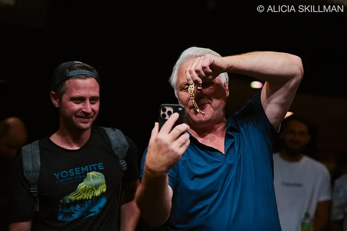 Yosef Fox shows off the bracelet