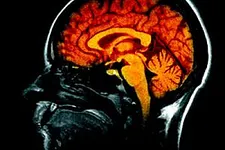 pkr foviance eeg poker